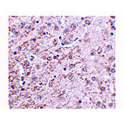 CRMP1 Antibody nterm 100µg