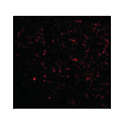 Anti-GRIK5 (RABBIT) Antibody, 100µg, Liquid (sterile filtered)