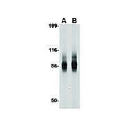 IPR1 Antibody nterm 100µg