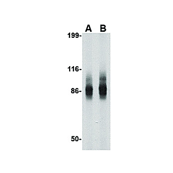IPR1 Antibody nterm 100µg
