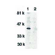 Anti-DNase II (RABBIT) Antibody, 100µg, Liquid (sterile filtered)