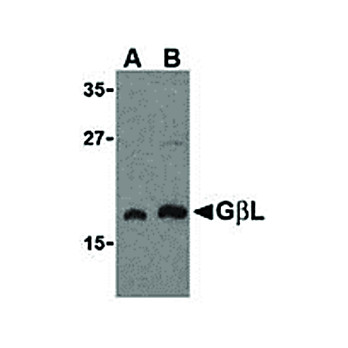 Anti-GBL (RABBIT) Antibody, 100µg, Liquid (sterile filtered)