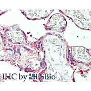 Anti-Plasminogen Activator Inhibitor 2 (RABBIT) Antibody, 25µL, Liquid (sterile filtered)
