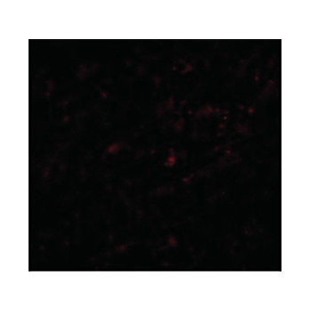 LASS5 Antibody nterm-18 100µg