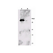 p90 RSK1 Antibody 100µg