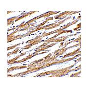 Anti-Programmed Cell Death 1 Ligand (PDL-1) (RABBIT) Antibody, 100µg, Liquid (sterile filtered)