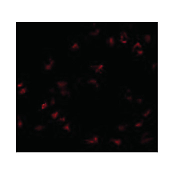 Anti-GNPDA1 (RABBIT) Antibody, 100µg, Liquid (sterile filtered)