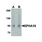 Anti-EphA10 (RABBIT) Antibody, 100µg, Liquid (sterile filtered)
