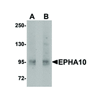 Anti-EphA10 (RABBIT) Antibody, 100µg, Liquid (sterile filtered)