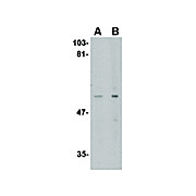LGI4 Antibody 100µg