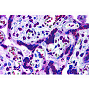 Anti-CARMA2 (RABBIT) Antibody, 100µg, Liquid (sterile filtered)