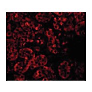Anti-JMJD8 (RABBIT) Antibody, 100µg, Liquid (sterile filtered)