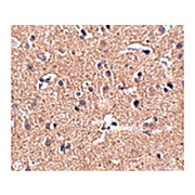 GALNT10 Antibody nterm 100µg