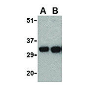 Anti-FAIM2 (RABBIT) Antibody, 100µg, Liquid (sterile filtered)