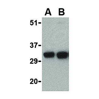 Anti-FAIM2 (RABBIT) Antibody, 100µg, Liquid (sterile filtered)