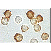 IRAK2 Antibody near cterm hu 100µg