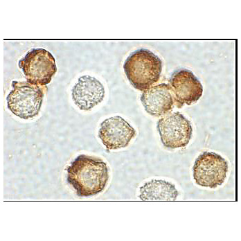 IRAK2 Antibody near cterm hu 100µg