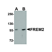 Anti-FREM2 (RABBIT) Antibody, 100µg, Liquid (sterile filtered)