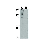 CDNF Antibody nterm 100µg