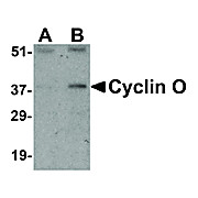 Cyclin O Antibody nterm 100µg