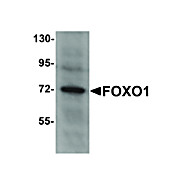 Anti-FOXO1 (RABBIT) Antibody, 100µg, Liquid (sterile filtered)