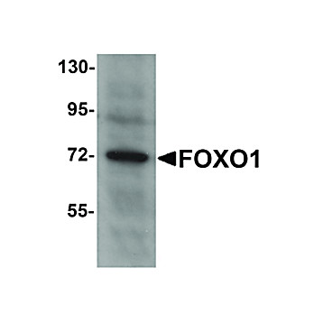 Anti-FOXO1 (RABBIT) Antibody, 100µg, Liquid (sterile filtered)