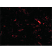 GALNT10 Antibody cterm 100µg