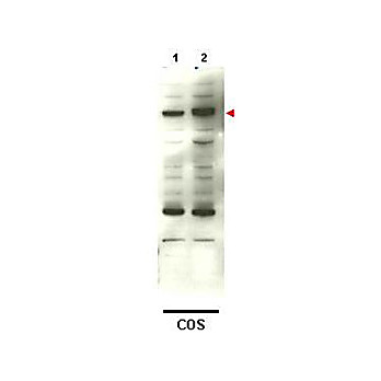 Anti-SMAD4 (RABBIT) Antibody, 100µg, Liquid (sterile filtered)