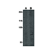 Anti-CNOT4 (RABBIT) Antibody, 100µg, Liquid (sterile filtered)