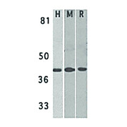 Anti-DAPK2 (RABBIT) Antibody, 100µg, Liquid (sterile filtered)