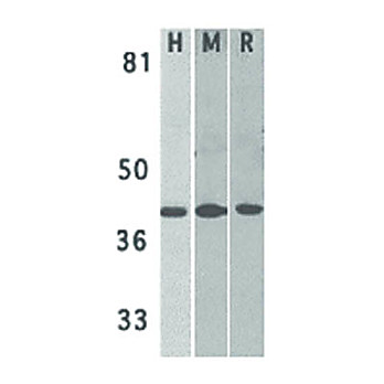 Anti-DAPK2 (RABBIT) Antibody, 100µg, Liquid (sterile filtered)