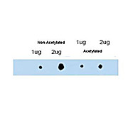 Anti-ATDC (RABBIT) Antibody, 100µg, Liquid (sterile filtered)