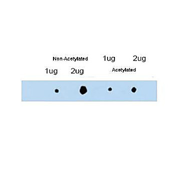 Anti-ATDC (RABBIT) Antibody, 100µg, Liquid (sterile filtered)