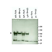 Anti-Heat shock protein HSP 90-alpha (RABBIT) Antibody, 100µg, Liquid (sterile filtered)