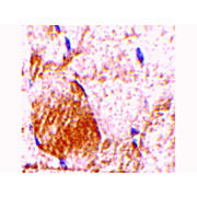IL-31 Antibody nterm 100µg