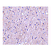 CTRP4 Antibody internal 100µg
