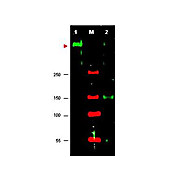 Anti-Serine/Threonine-Protein Kinase ATR (RABBIT) Antibody, 100µg, Liquid (sterile filtered)