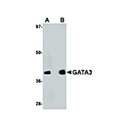 Anti-GATA3 (RABBIT) Antibody, 100µg, Liquid (sterile filtered)