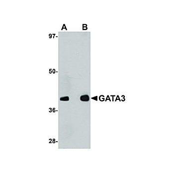 Anti-GATA3 (RABBIT) Antibody, 100µg, Liquid (sterile filtered)