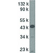 Caspase-9 internal Antibody 100µg