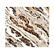 Anti-GLS2 (RABBIT) Antibody, 100µg, Liquid (sterile filtered)