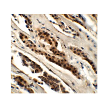 Anti-GLS2 (RABBIT) Antibody, 100µg, Liquid (sterile filtered)