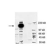 Anti-Cas5 (RABBIT) Antibody, 100µg, Liquid (sterile filtered)