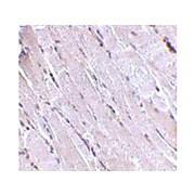 Anti-Wnt10b (Rabbit) Antibody, 100µg, Liquid (sterile filtered)