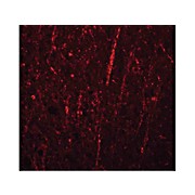 Anti-FRMPD4 (RABBIT) Antibody, 100µg, Liquid (sterile filtered)