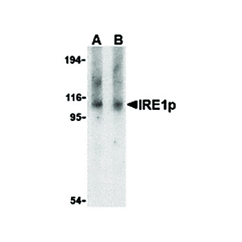 IRE1p Antibody internal 100µg