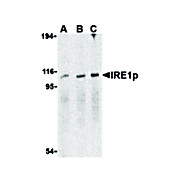 IRE1p Antibody cterm 100µg