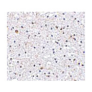 Anti-PDCD1 (RABBIT) Antibody, 100µg, Liquid (sterile filtered)