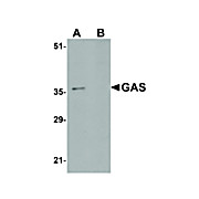 Anti-GAS (RABBIT) Antibody, 100µg, Liquid (sterile filtered)