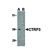 CTRP3 Antibody 100µg